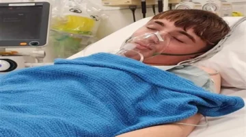 التدخين الإلكتروني يؤدي إلى انهيارات رئوية متكررة ويستدعي جراحة لإزالة قطعة سوداء من رئة مراهق نيوزيلندي 1